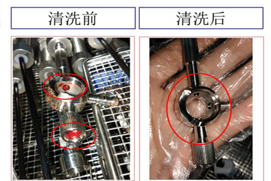 真空超聲波清洗機,輕松解決醫療器械清洗難題